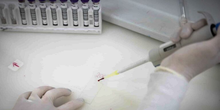 Paciente em SP com suspeita de ebola testa positivo para meningite