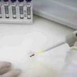 Secretaria de Saúde de SP investiga novo caso suspeito de ebola